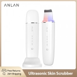 רק 18$\63 ש״ח עם הקופון ANLAN01 למכשיר ניקוי העור המתקדם ANLAN Ultrasonic!!